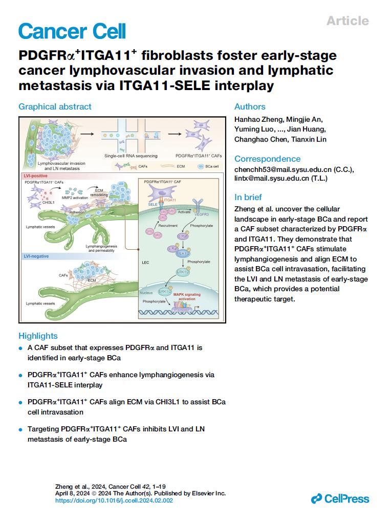 研究揭示早期膀胱癌脈管癌栓形成的關(guān)鍵分子機(jī)制